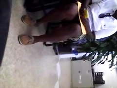 Upskirt at Dentist office